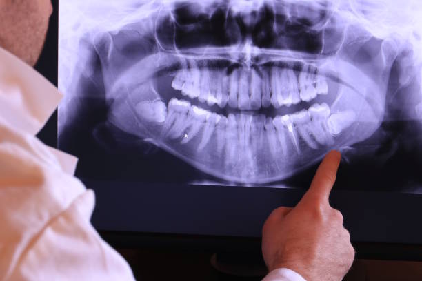 Best Emergency Root Canal Treatment in Atascocita, TX